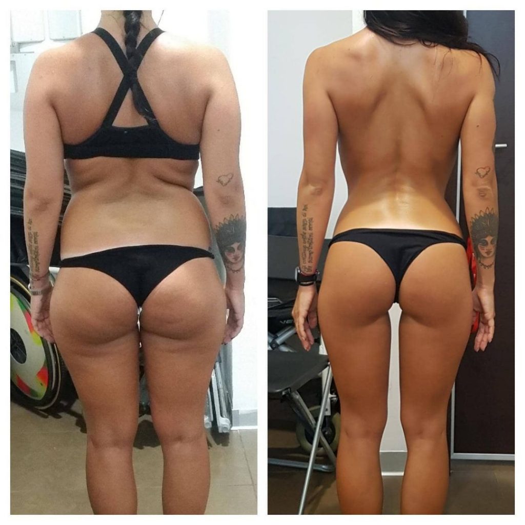 prima e dopo